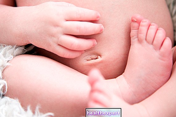 Nabelbruch beim Neugeborenen: Symptome, Diagnose und Behandlung