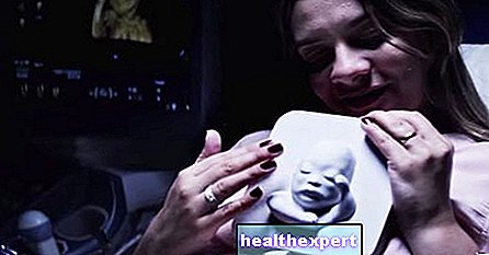 Родителство - Сляпа бъдеща майка може да види бебето си благодарение на 3D ултразвук. Гледайте трогателното видео от срещата между Татяна и нейното бебе