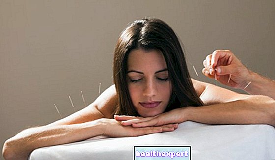 Acupuncture: an ancient but much discussed technique - In Shape
