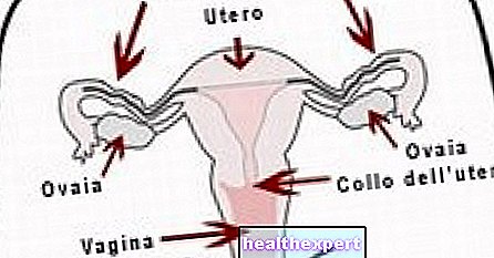 Cancer ovarian - In Forma