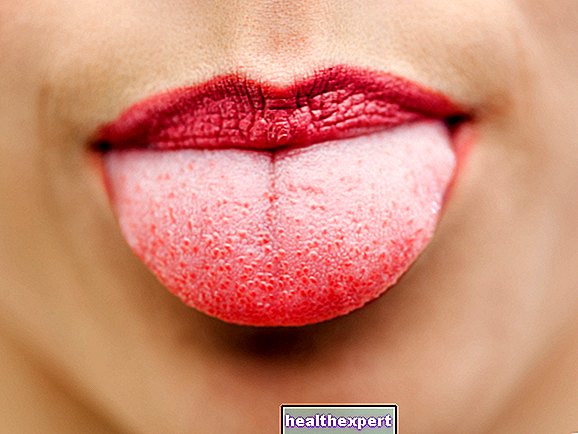 I Form - Fläckar på tungan: vad är de vanligaste orsakerna?